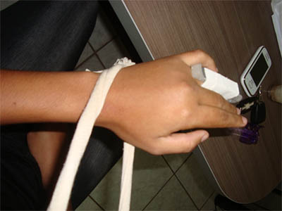 Agente mostra o dedo quebrado durante motim e diz que direção do presidio quis priorizar atendimento as presas